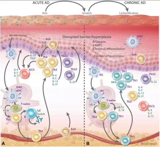 Dupilumab,达必妥