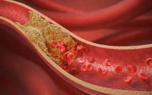 Enlicitide Decanoate
